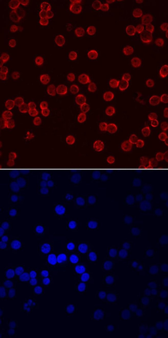 EMP Antibody in Immunocytochemistry (ICC/IF)