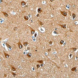 LRRC4C Antibody in Immunohistochemistry (Paraffin) (IHC (P))