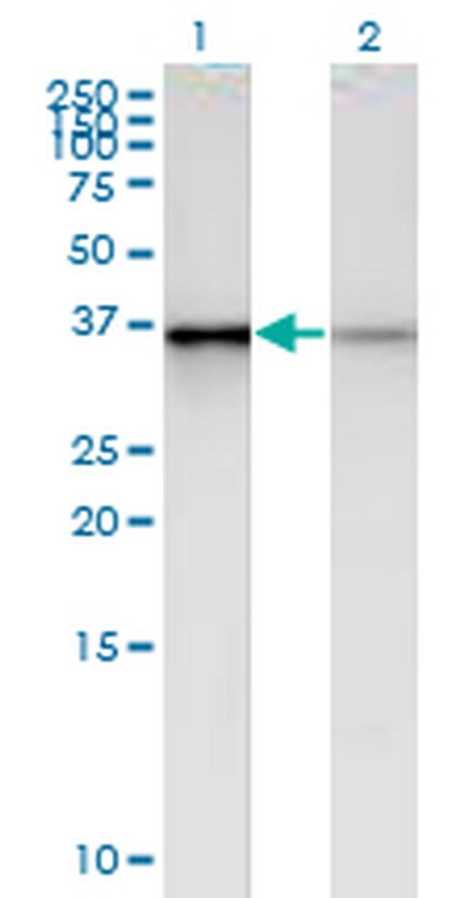 PHC2 Antibody in Western Blot (WB)