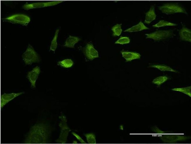 RPLP1 Antibody in Immunocytochemistry (ICC/IF)