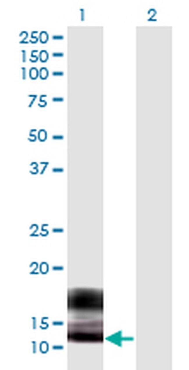 SPRR2F Antibody in Western Blot (WB)