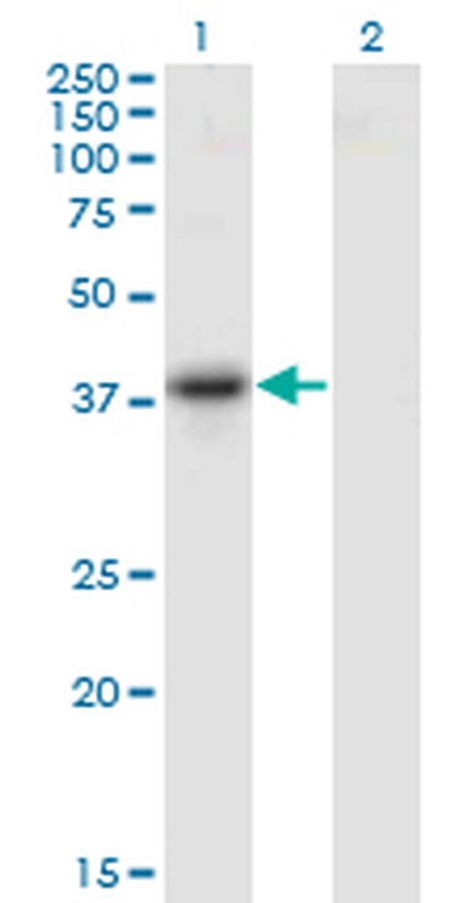 SERPINB10 Antibody in Western Blot (WB)