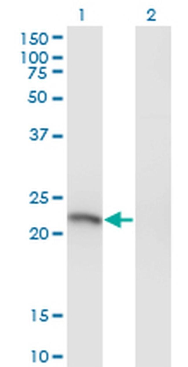 SSX3 Antibody in Western Blot (WB)