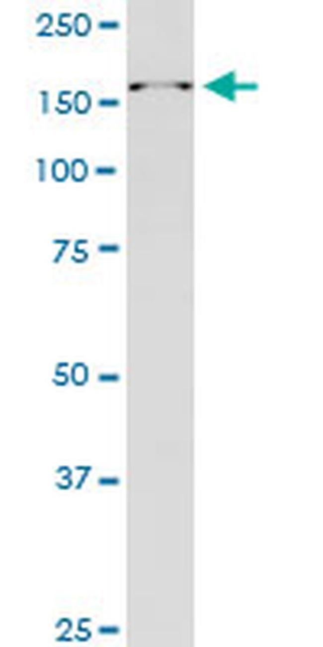 RAI1 Antibody in Western Blot (WB)