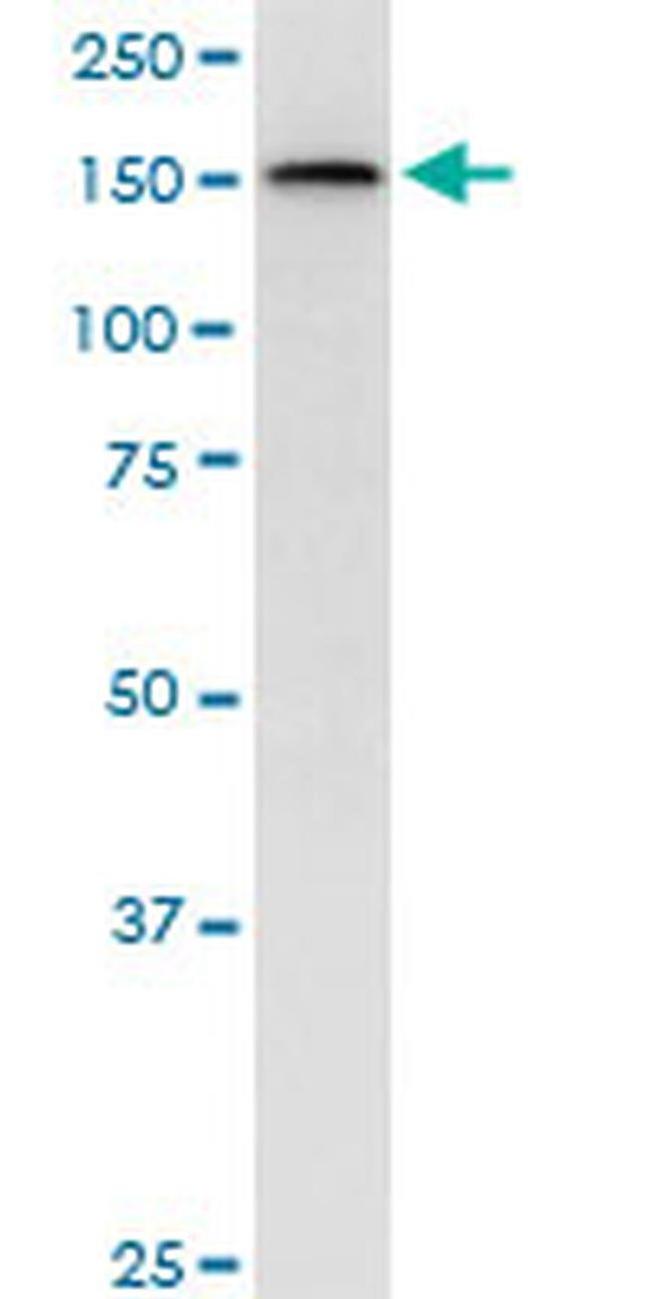 TOPBP1 Antibody in Western Blot (WB)
