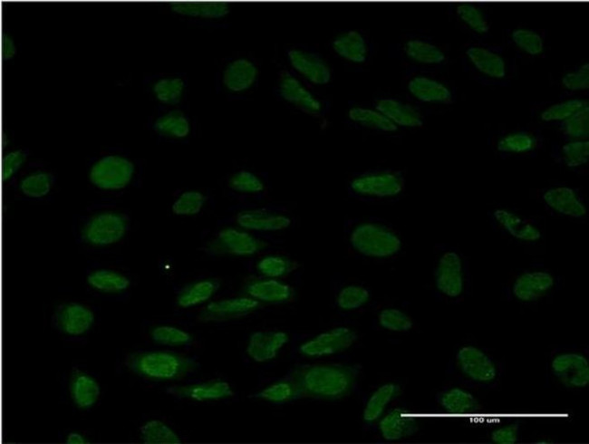 LSM6 Antibody in Immunocytochemistry (ICC/IF)