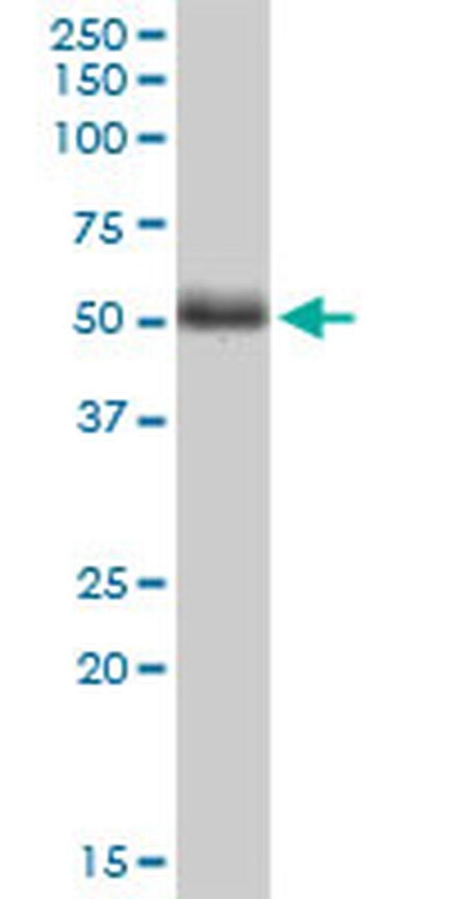 TWF2 Antibody in Western Blot (WB)
