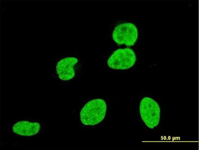VPS8 Antibody in Immunocytochemistry (ICC/IF)