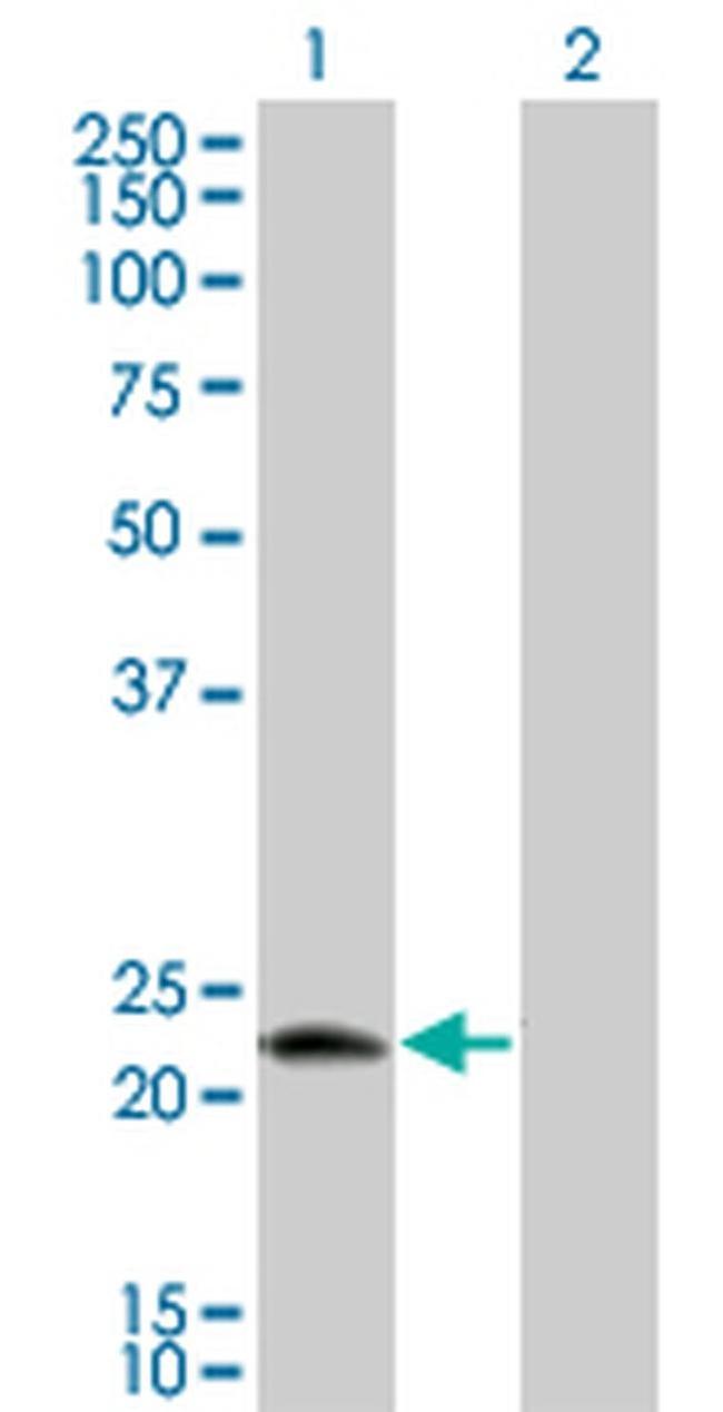 RNFT1 Antibody in Western Blot (WB)