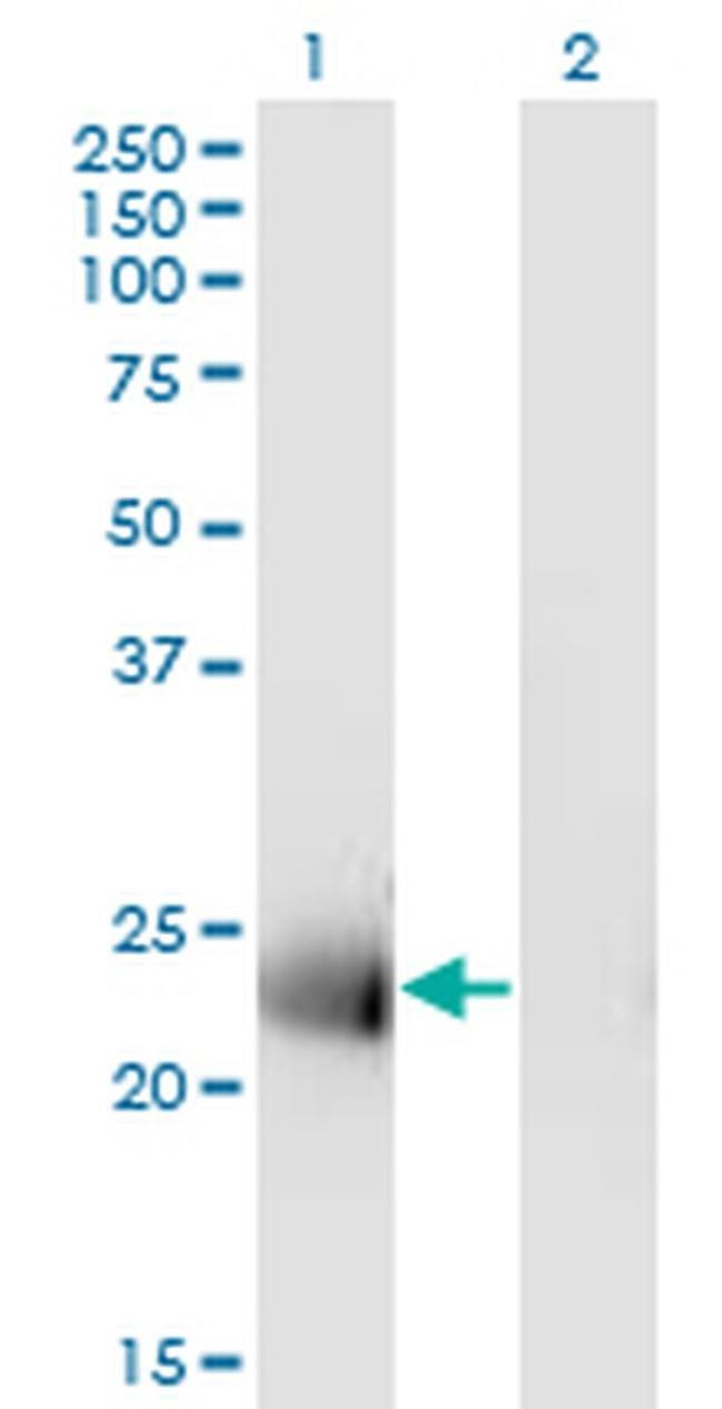 MS4A12 Antibody in Western Blot (WB)