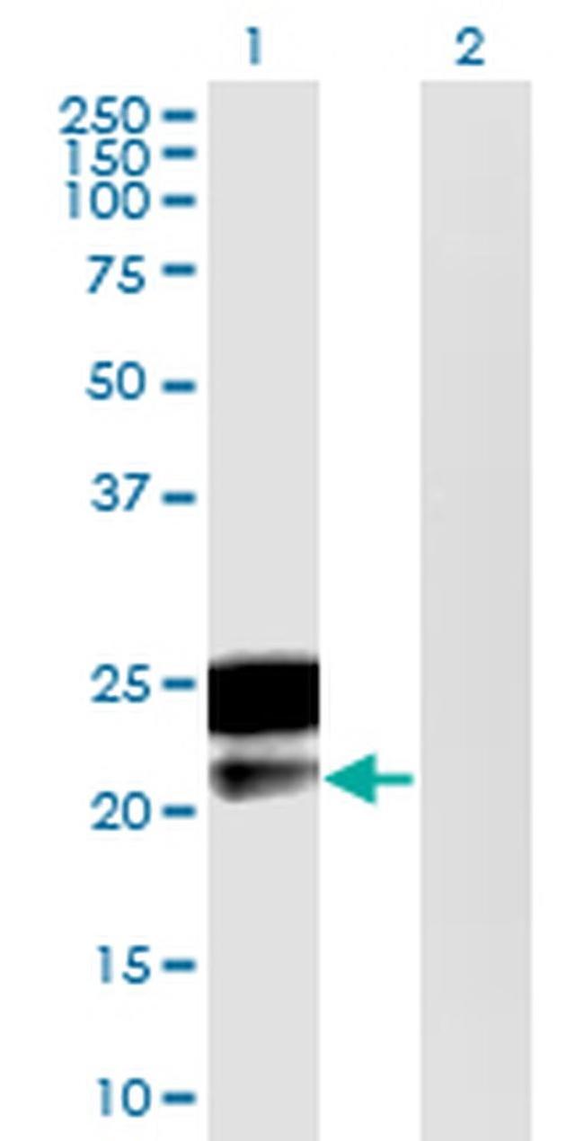 DMRTB1 Antibody in Western Blot (WB)