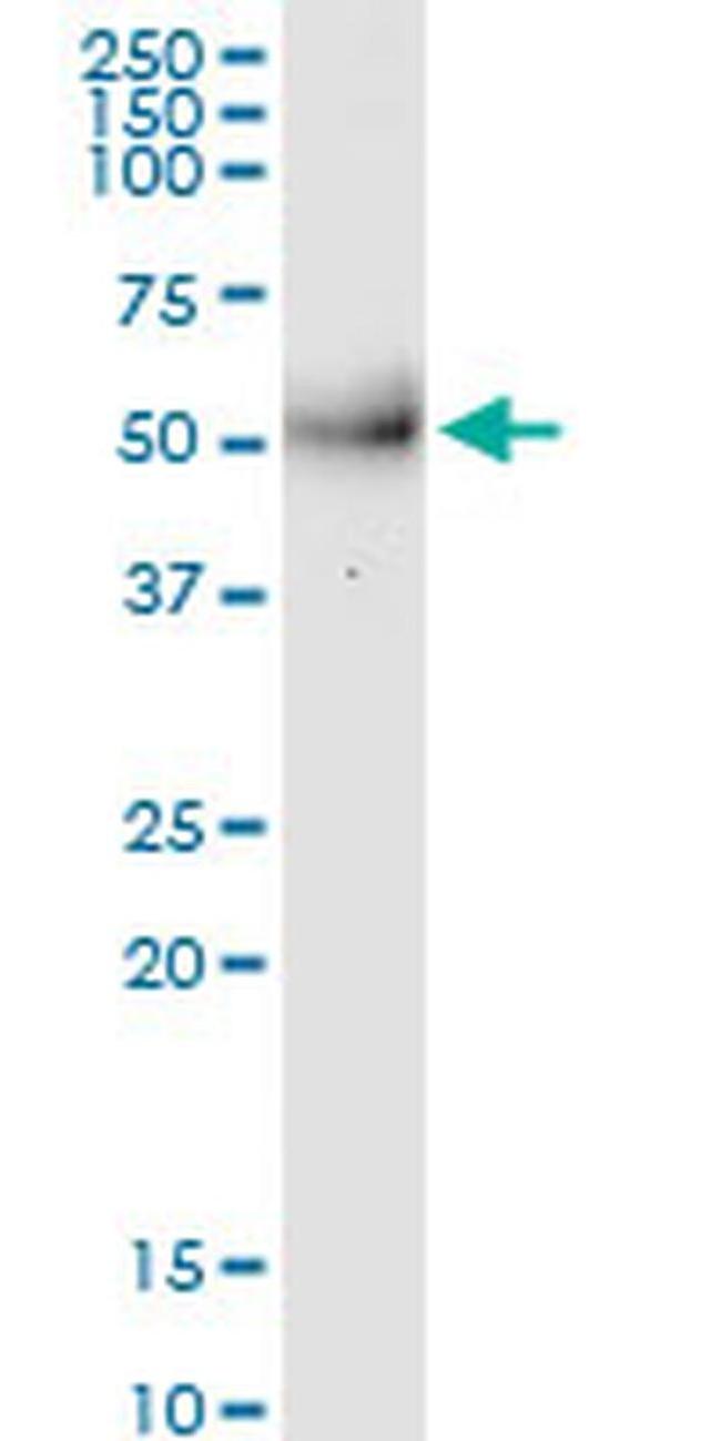 MPPE1 Antibody in Western Blot (WB)