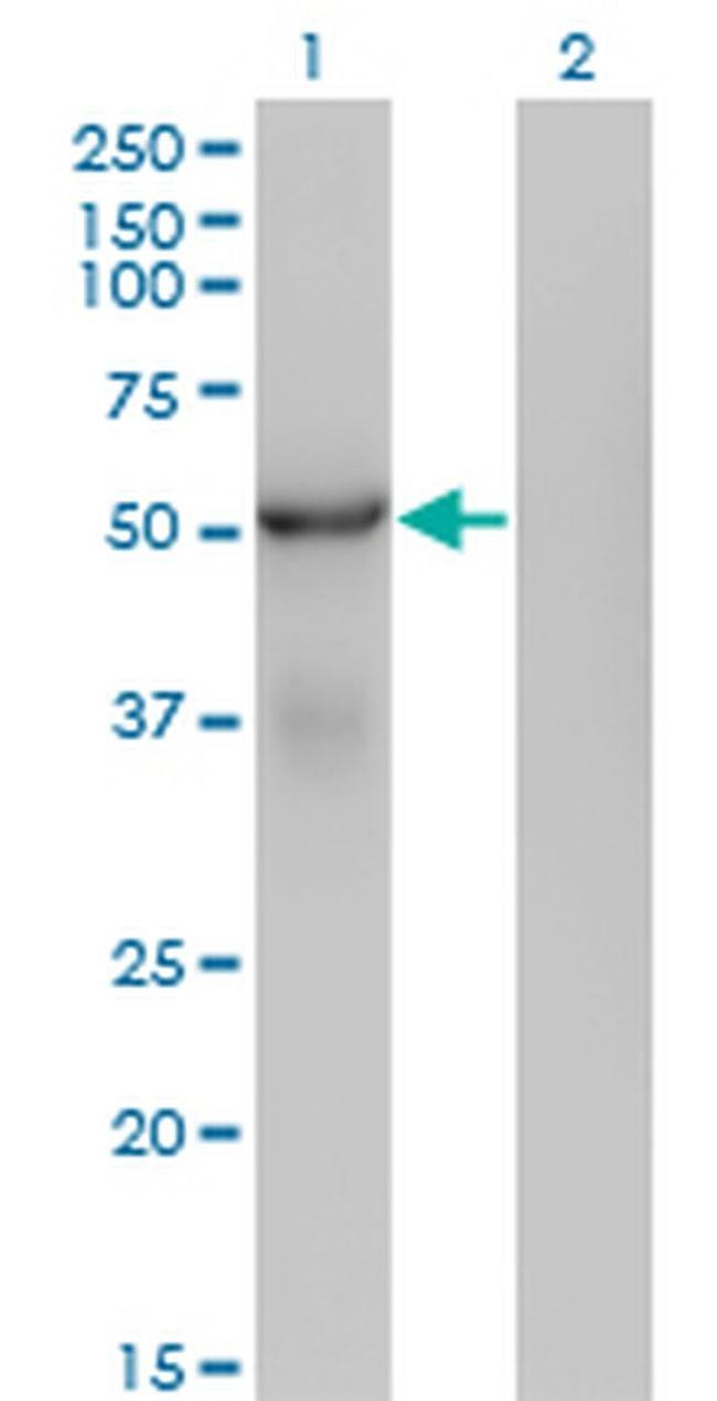 SNX25 Antibody in Western Blot (WB)
