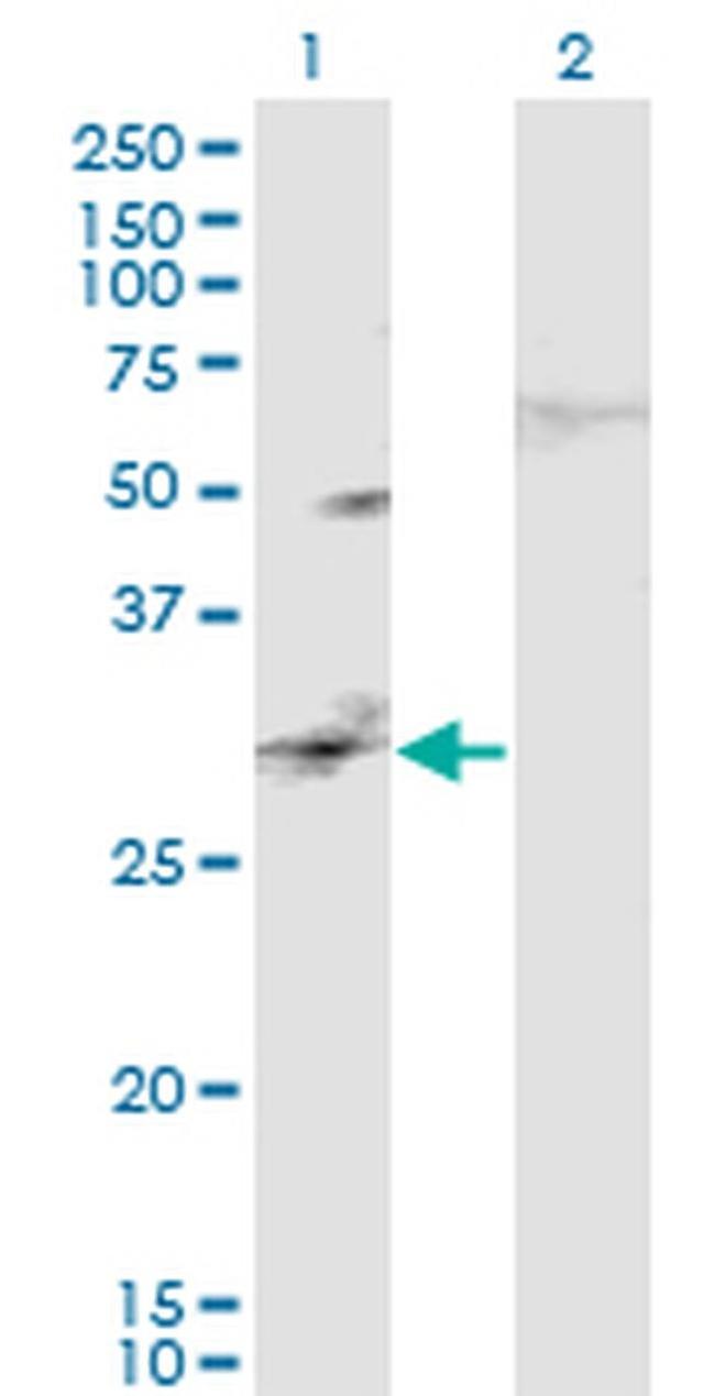 CAPS2 Antibody in Western Blot (WB)