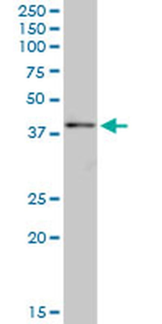 SYCE1 Antibody in Western Blot (WB)