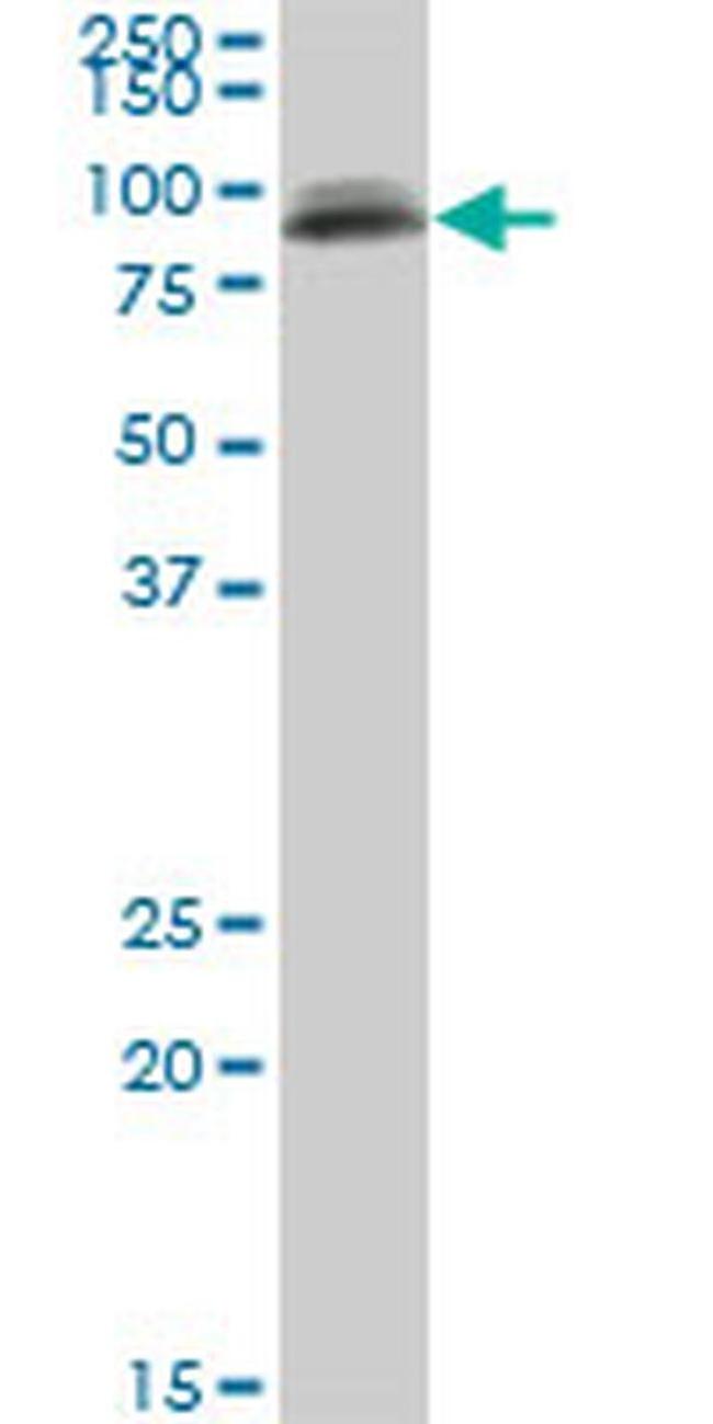 PIGS Antibody in Western Blot (WB)