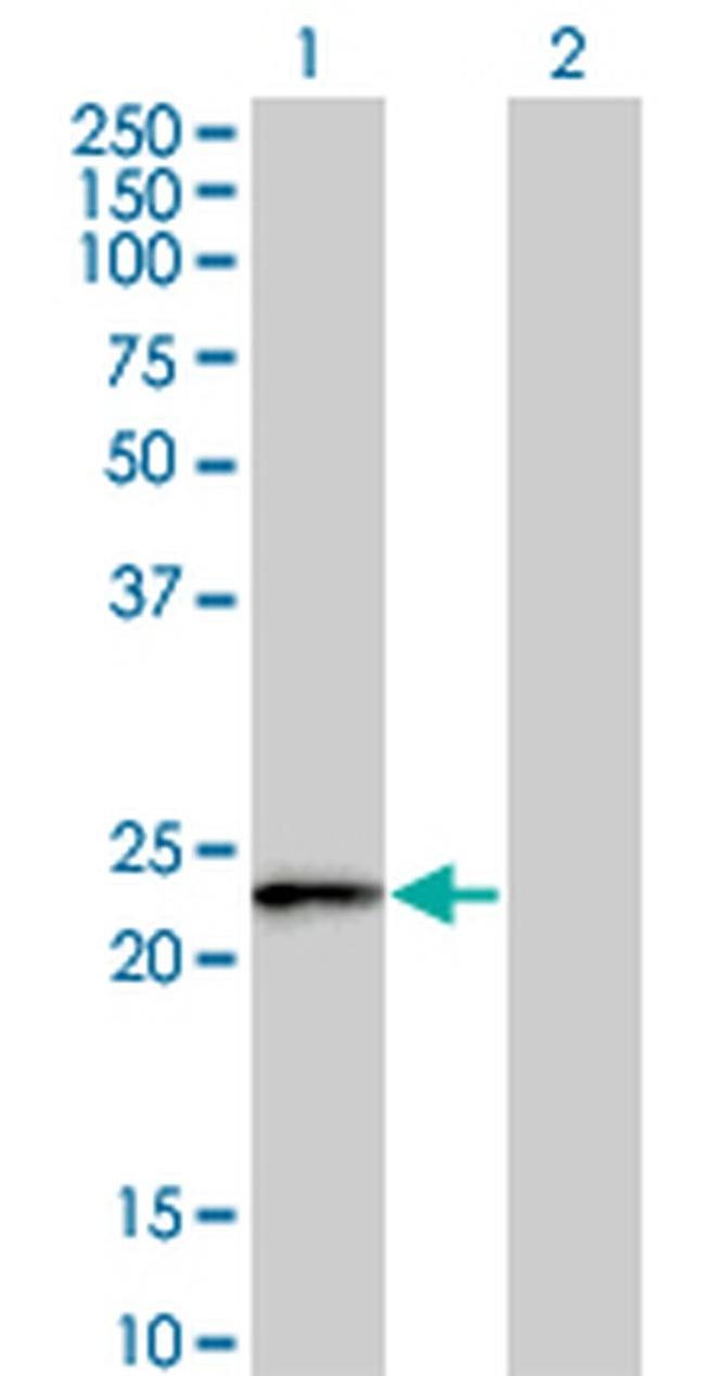 FBXO36 Antibody in Western Blot (WB)
