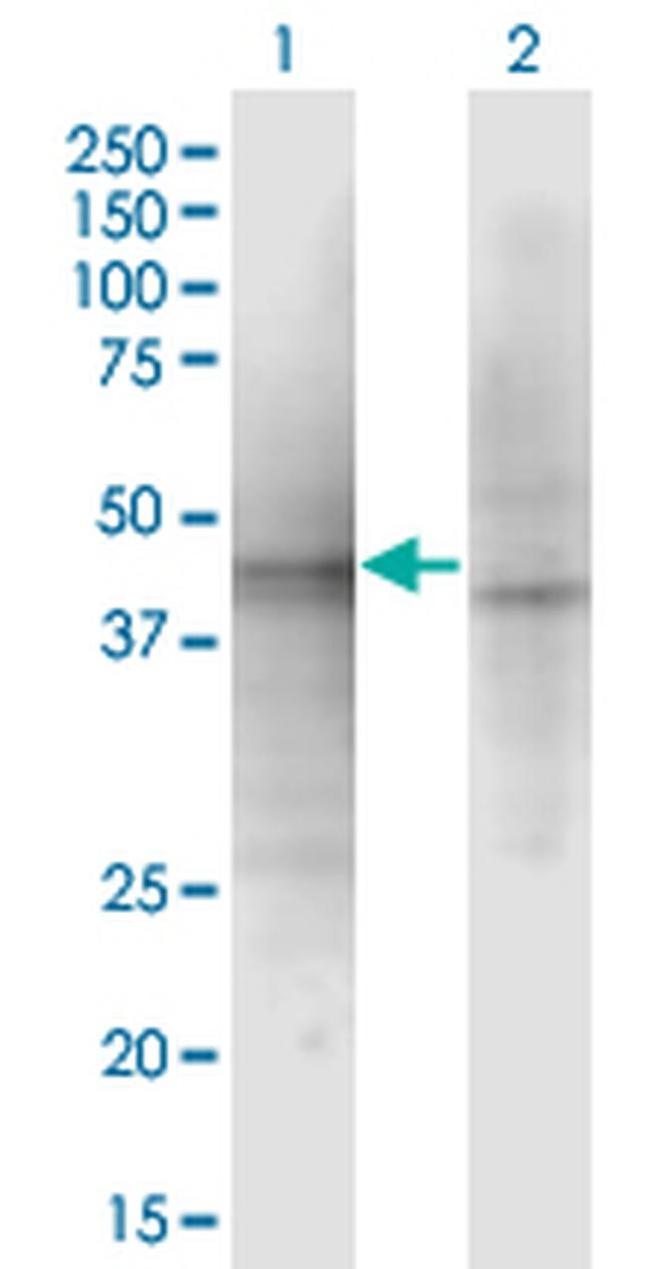 ASZ1 Antibody in Western Blot (WB)