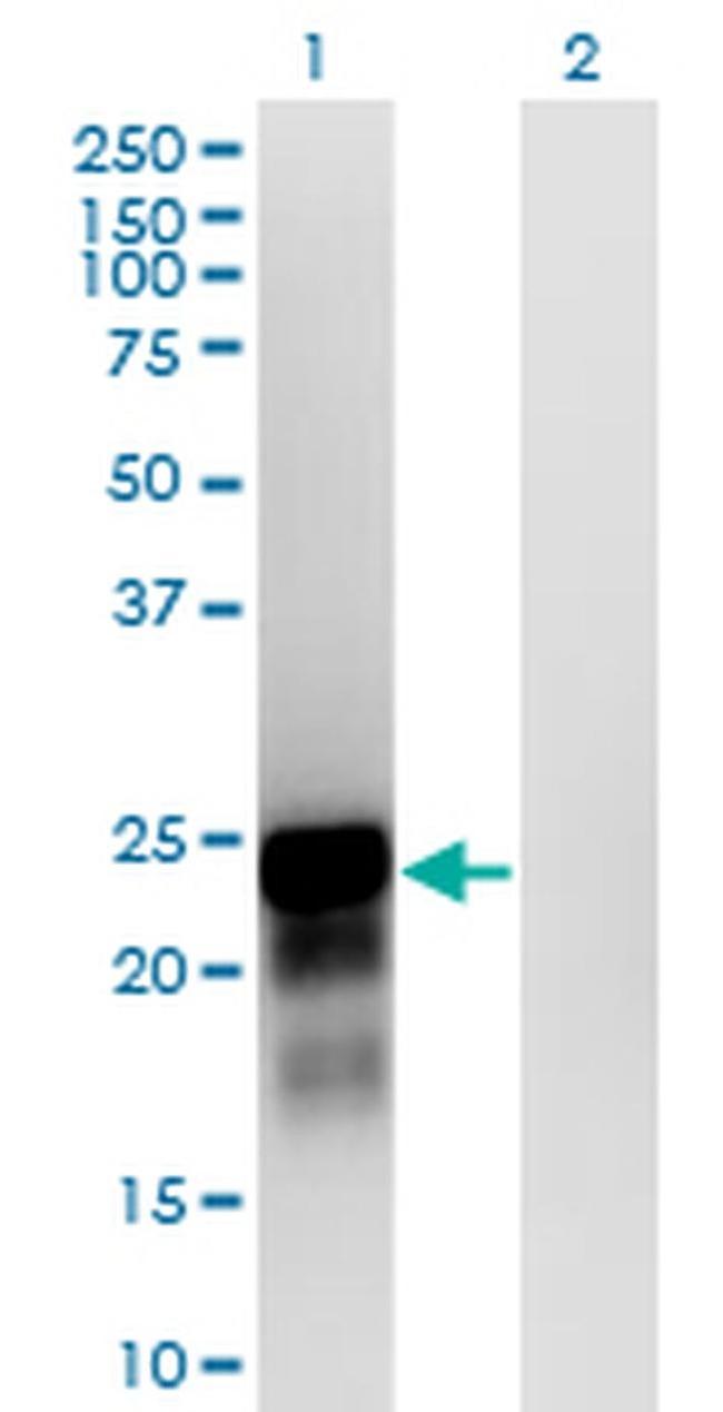 SPANXN3 Antibody in Western Blot (WB)