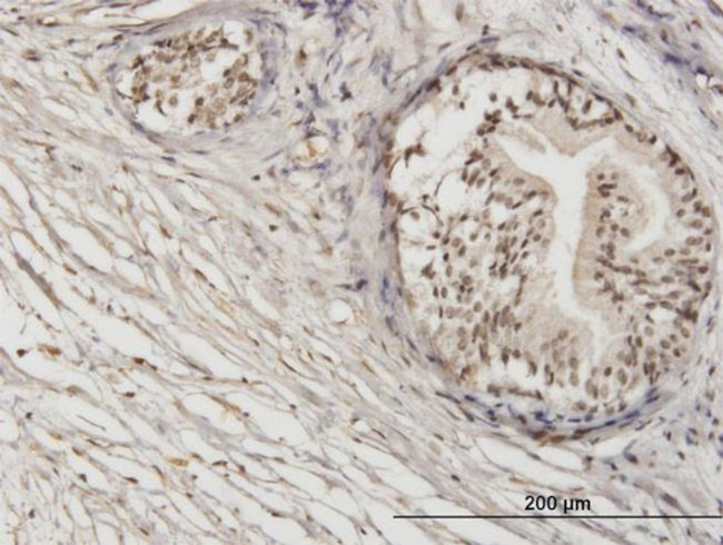 ZNF92 Antibody in Immunohistochemistry (Paraffin) (IHC (P))