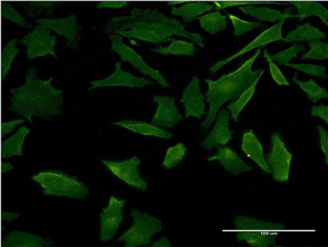 DFNB31 Antibody in Immunocytochemistry (ICC/IF)