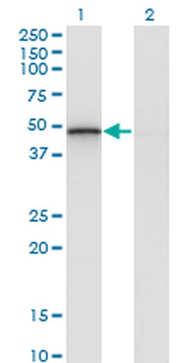 RCAN2 Antibody in Western Blot (WB)