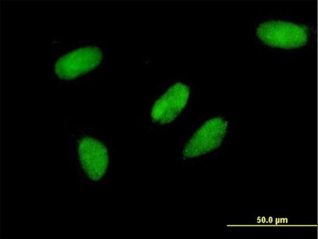 TCEA3 Antibody in Immunocytochemistry (ICC/IF)