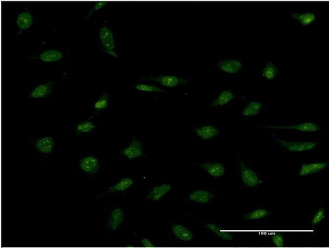 PPP2R3B Antibody in Immunocytochemistry (ICC/IF)