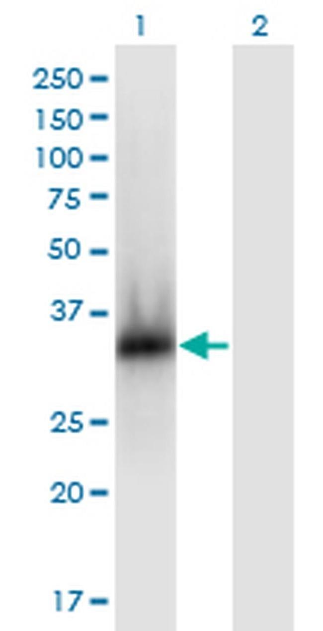 ZNF511 Antibody in Western Blot (WB)
