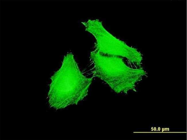 FBXL22 Antibody in Immunocytochemistry (ICC/IF)