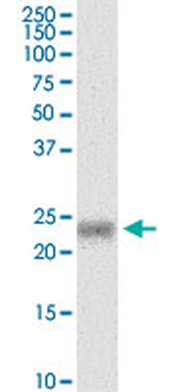 MYL5 Antibody in Western Blot (WB)