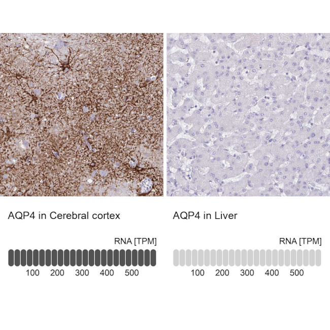 Aquaporin 4 Antibody in Immunohistochemistry (IHC)