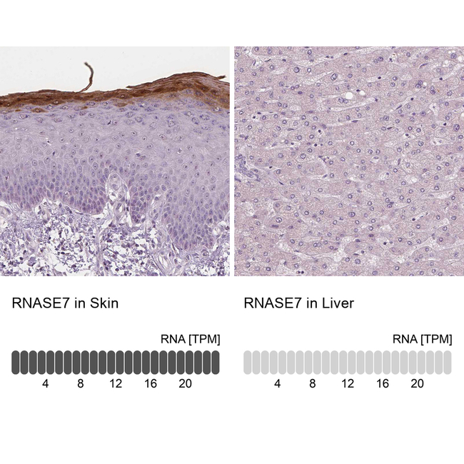 RNASE7 Antibody in Immunohistochemistry (Paraffin) (IHC (P))