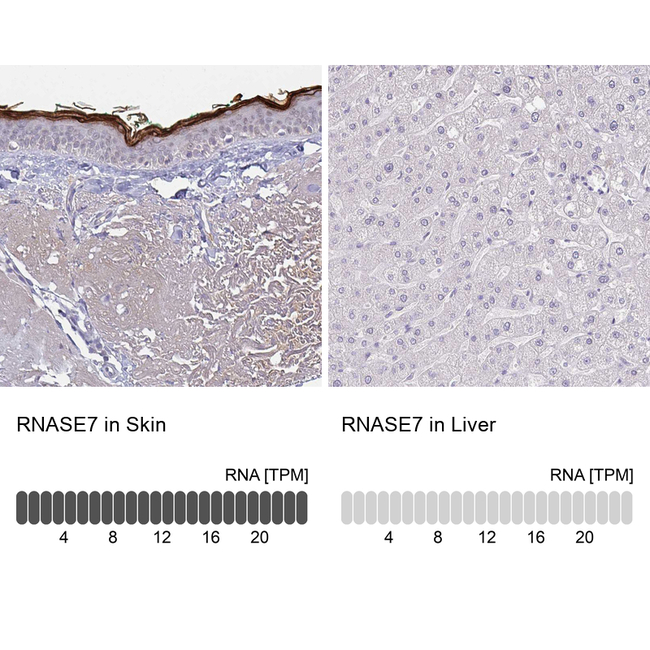 RNASE7 Antibody in Immunohistochemistry (Paraffin) (IHC (P))