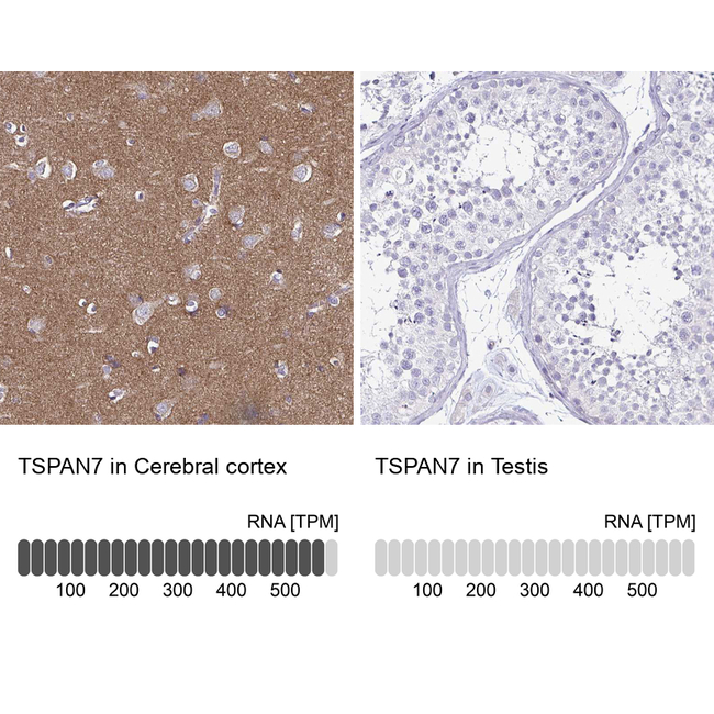 TSPAN7 Antibody in Immunohistochemistry (Paraffin) (IHC (P))