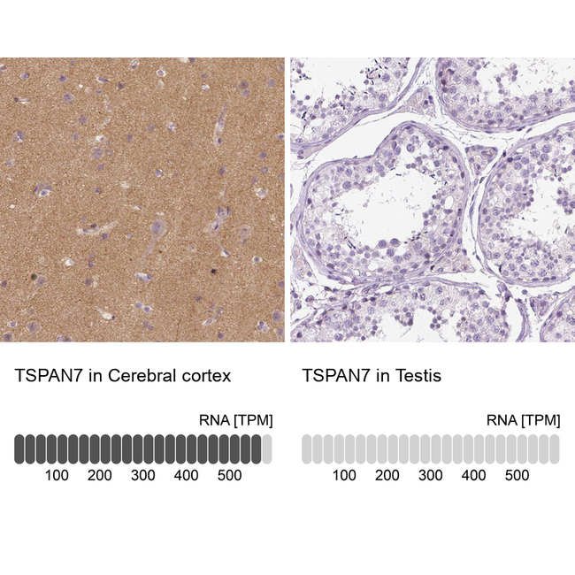TSPAN7 Antibody in Immunohistochemistry (Paraffin) (IHC (P))