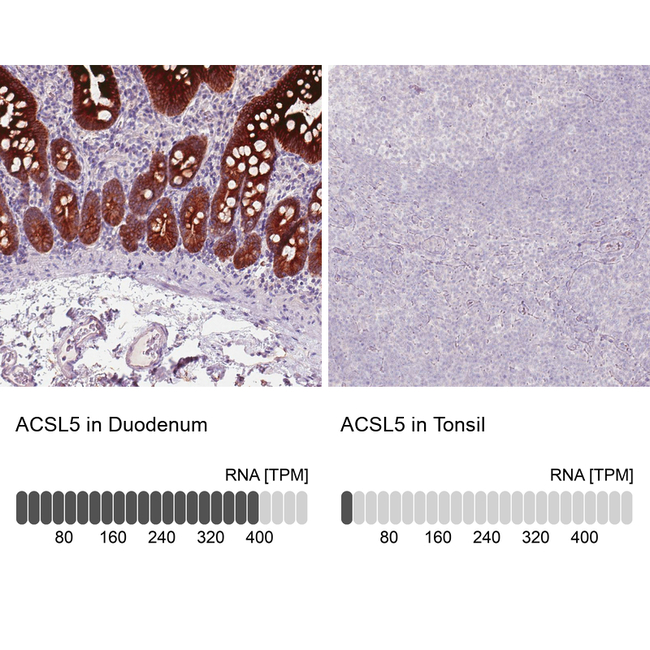 ACSL5 Antibody in Immunohistochemistry (Paraffin) (IHC (P))