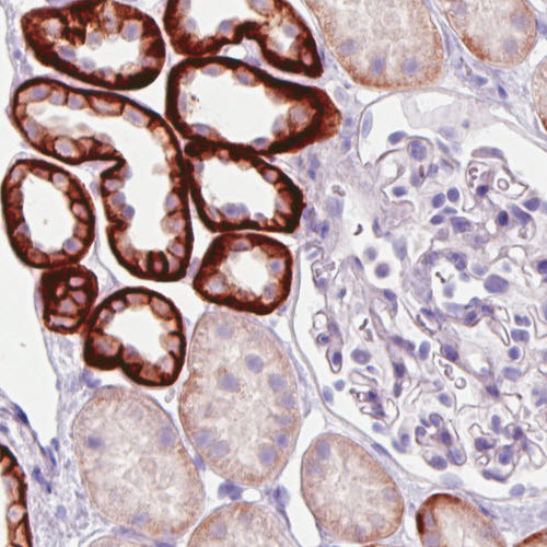 Carbonic Anhydrase XII Antibody in Immunohistochemistry (Paraffin) (IHC (P))