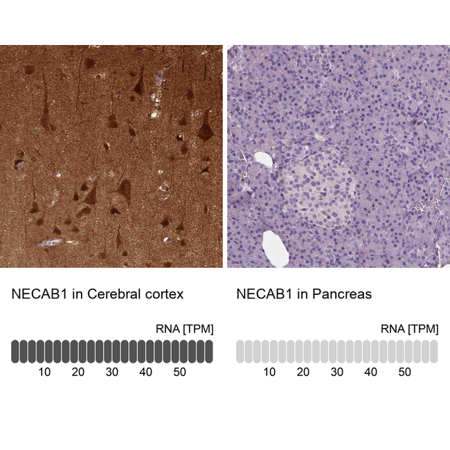 NECAB1 Antibody in Immunohistochemistry (Paraffin) (IHC (P))