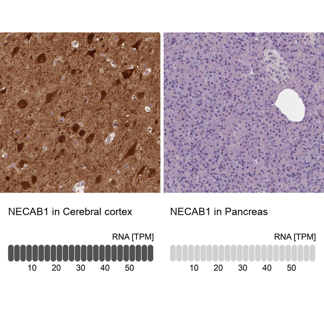 NECAB1 Antibody in Immunohistochemistry (Paraffin) (IHC (P))