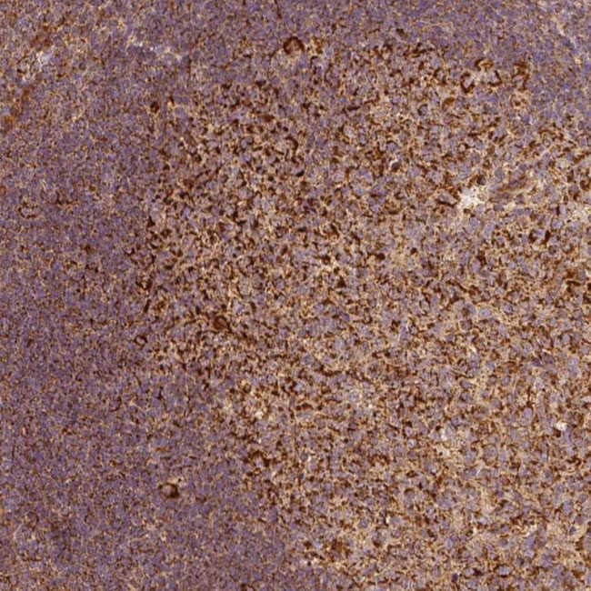 PGAM5 Antibody in Immunohistochemistry (Paraffin) (IHC (P))