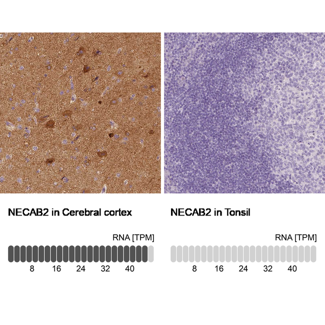 NECAB2 Antibody in Immunohistochemistry (Paraffin) (IHC (P))