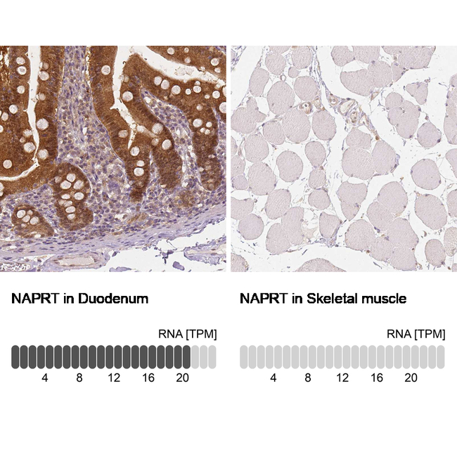 NAPRT1 Antibody in Immunohistochemistry (Paraffin) (IHC (P))