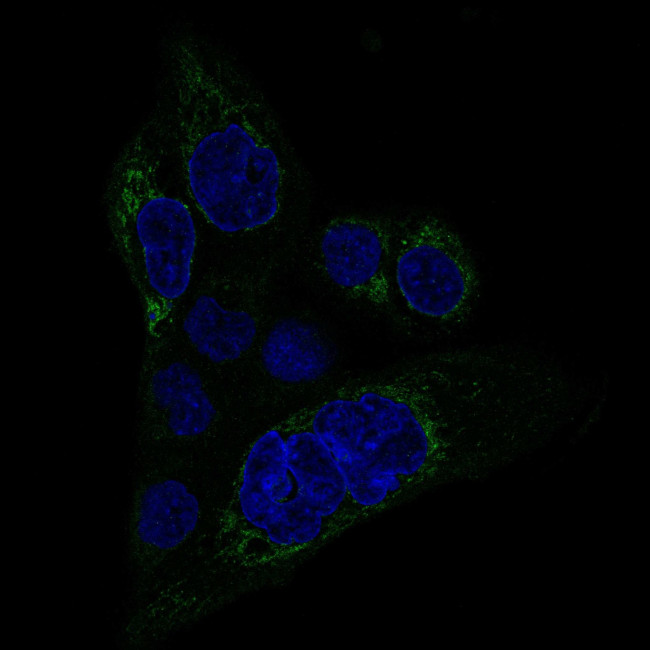 MACC1 Antibody in Immunocytochemistry (ICC/IF)