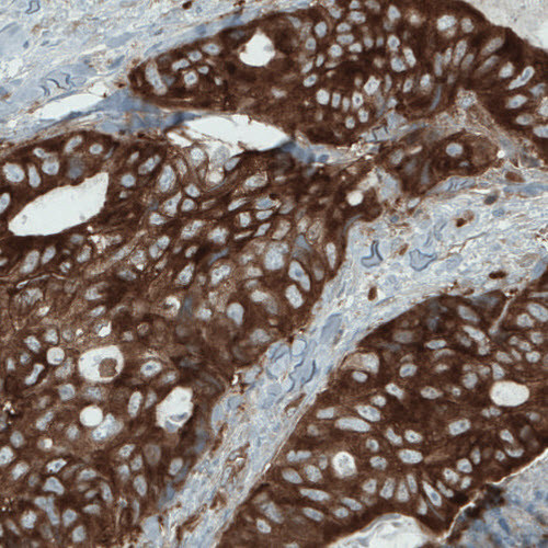 DIAPH2 Antibody in Immunohistochemistry (Paraffin) (IHC (P))