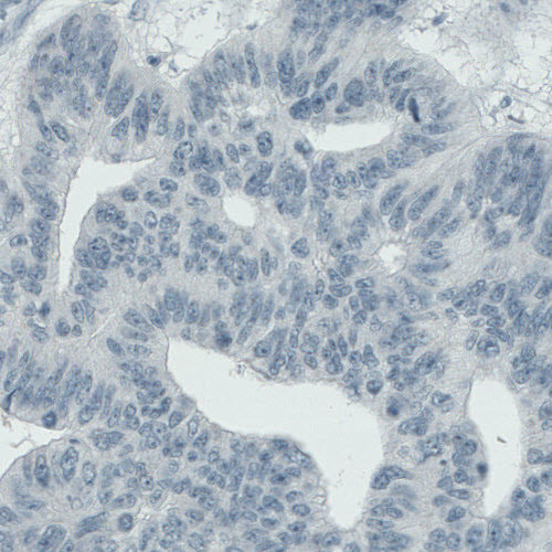 ALP Antibody in Immunohistochemistry (Paraffin) (IHC (P))