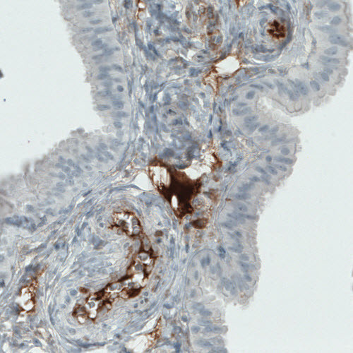 ITIH4 Antibody in Immunohistochemistry (Paraffin) (IHC (P))