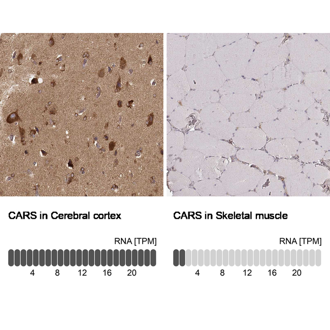CARS Antibody in Immunohistochemistry (Paraffin) (IHC (P))