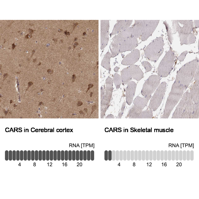 CARS Antibody in Immunohistochemistry (Paraffin) (IHC (P))