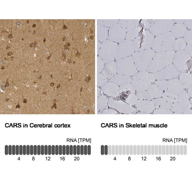CARS Antibody in Immunohistochemistry (Paraffin) (IHC (P))